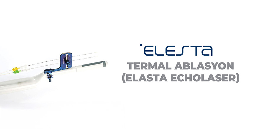 Termal Ablasyon (Elasta Echolazer)