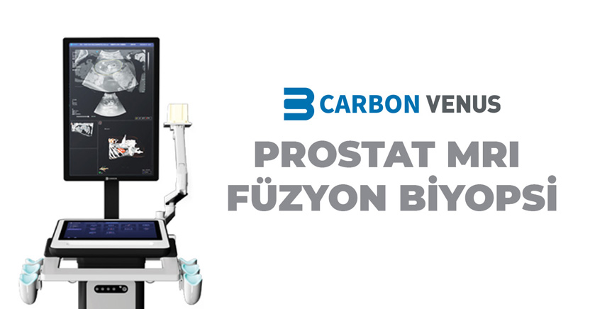 Prostat MRI Füzyon Biyopsi