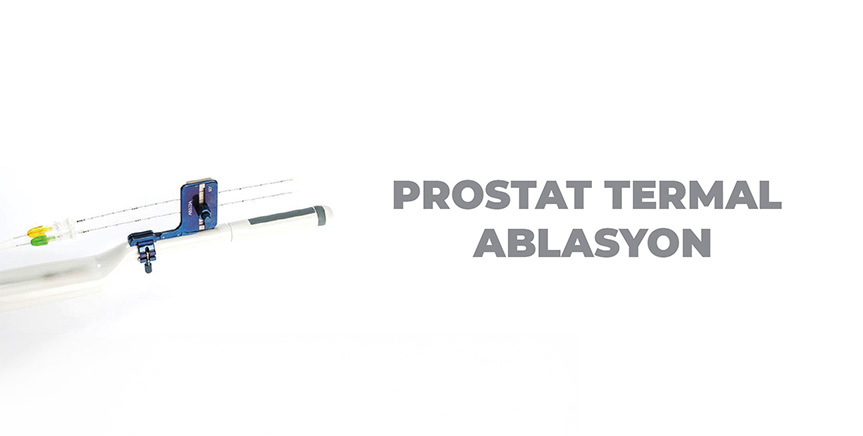 Prostat Termal Ablasyon