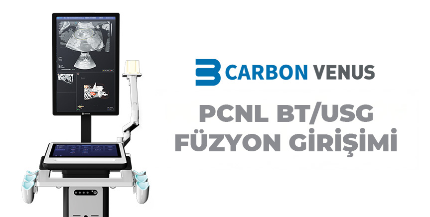 PCNL BT/USG Füzyon Girişimi